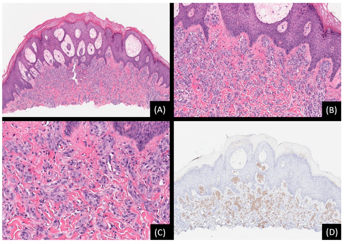 Genes MDPI tweet media