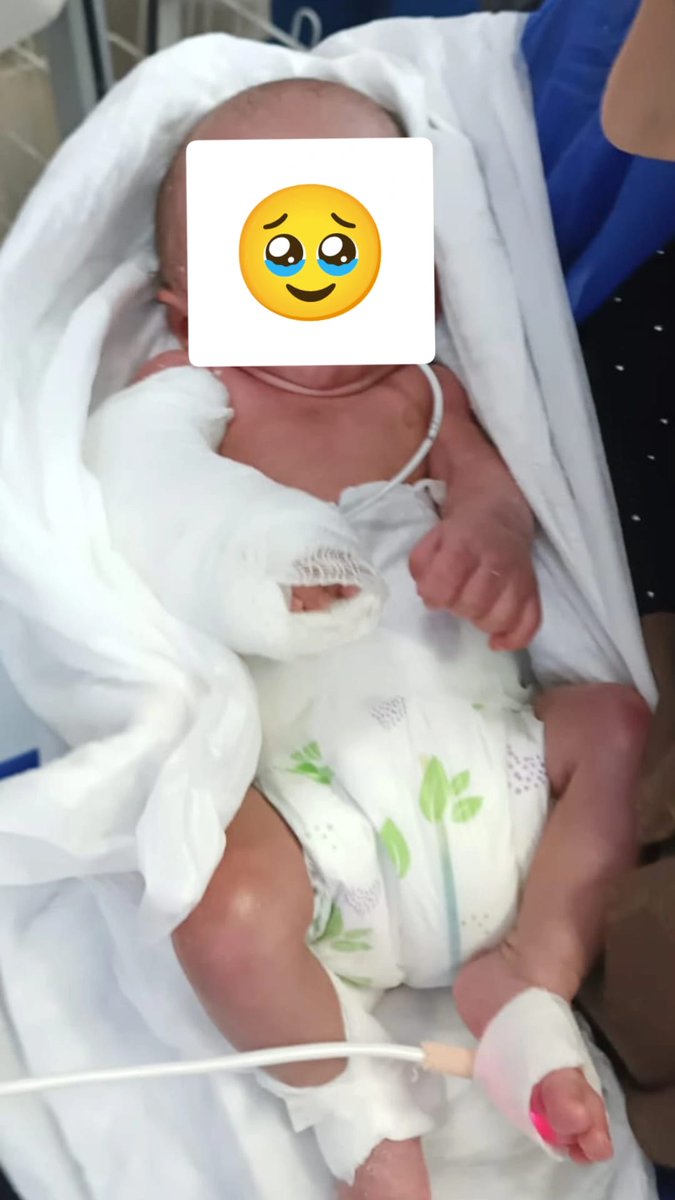 Kol kırılır yen içinde kalır, gerçekler ortaya çıkar.

Özel Şanmet Hastanesi'nde 3 ay önce bir bebek dünyaya geldi ve Küvöz'e alındı. 

Bu hafta başında babası bebeğini gördü kolu sağlamdı. İki gün önce de bebeğin kolunun alçıda olduğu görüldü. 

Bebeğin koluna görevli hemşire