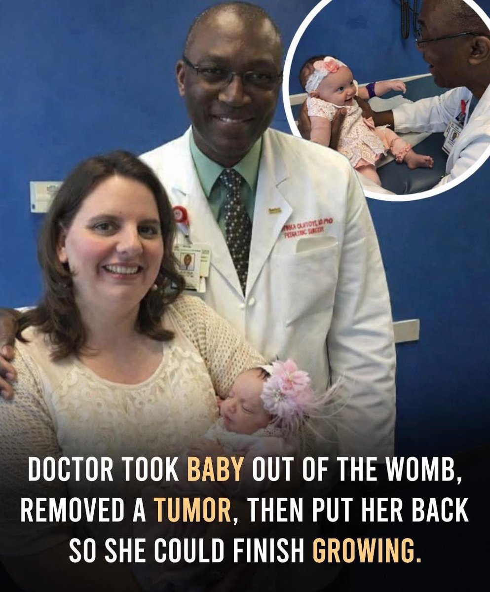 اس سرجری نے میڈیکل سائنس کے 
اصولوں کو نئے سرے سے وضع کر دیا ہے:-
تقریباً 23 ہفتوں کی حاملہ ہونے پر، ڈاکٹروں کو ایک خاتون کے پیٹ میں موجود اماس کے بچے میں جان لیوا ٹیومر کا پتہ چلا۔ ایک جرأت مندانہ طریقہ کار میں، انہوں نے اسے عارضی طور پر رحم سے نکال کر ٹیومر کو جسم سے علیحدہ کر