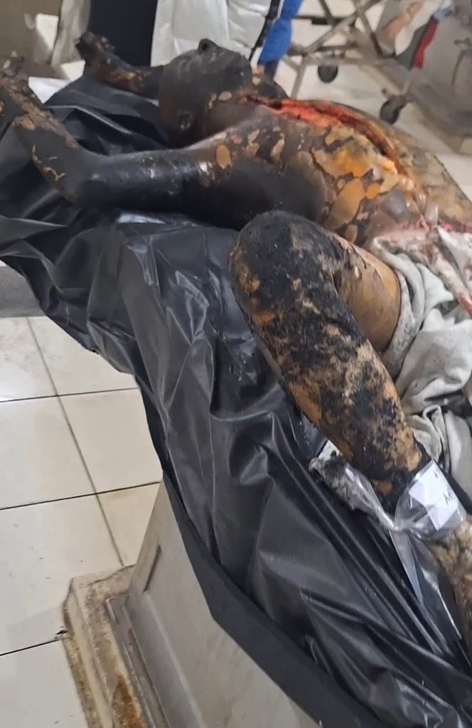 GhorbaniiNiyak's tweet photo. ⚠️ Warning: Distressing images ⚠️

The burned body and torn chest of an Iranian man whose only “crime” was wanting to free himself from the grip of the Islamic terrorist regime.

Every day, a new dimension of the crimes committed by the terrorists of the Islamic Republic is exposed crimes that are no different from those committed by Hamas terrorists against the people of Israel.