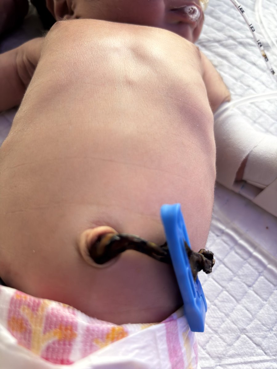 adeebalam20's tweet photo. Maternal causes for the given findings in newborn? https://t.co/alS7LkSXSe