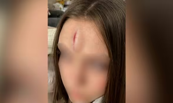 This is what mixed sex toilets mean for girls.

A girl was taken to hospital after she went into one of the "private cubicles" these regressive misogynists like to boast about, and a teenage boy donkey-kicked the door into her face as he tried to get in to photograph her.