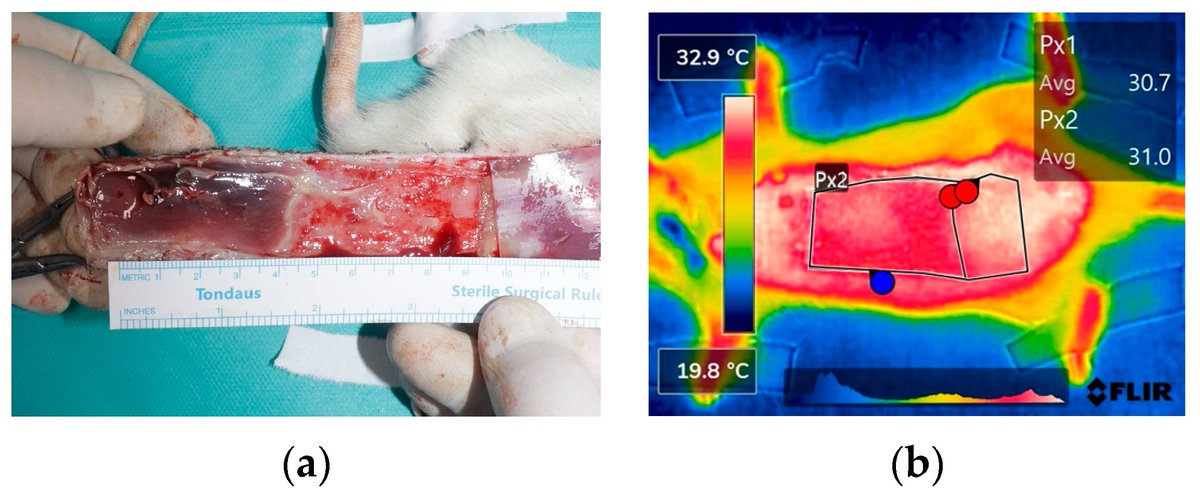 Bioeng_MDPI's tweet photo. 💥Highly recommended publication: "An Experimental and Clinical Study of Flap Monitoring with an Analysis of the Clinical Course of the Flap Using an Infrared Thermal Camera"
🔗https://t.co/SlhMLCL9Wd
🏫@UCLMS
📌#FlapMonitoring #ThermalCamera #ClinicalStudy https://t.co/vlvDshGJoW