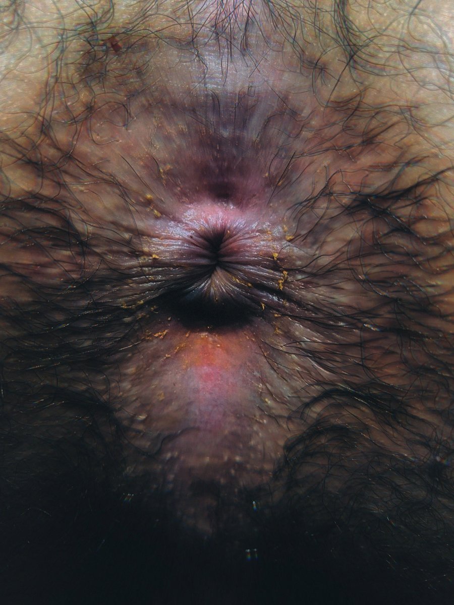 Heavy ripe scent leaking out