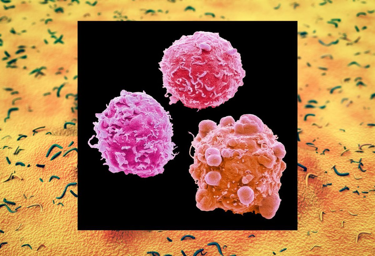 Colonoscopies are still the gold standard if cancer is suspected in a patient. And it will benefit patients most if a cancer is found and removed in the adenoma-carcinoma sequence (the development of cancerous change in a dysplastic polypoid lesion).

The prognosis of patients