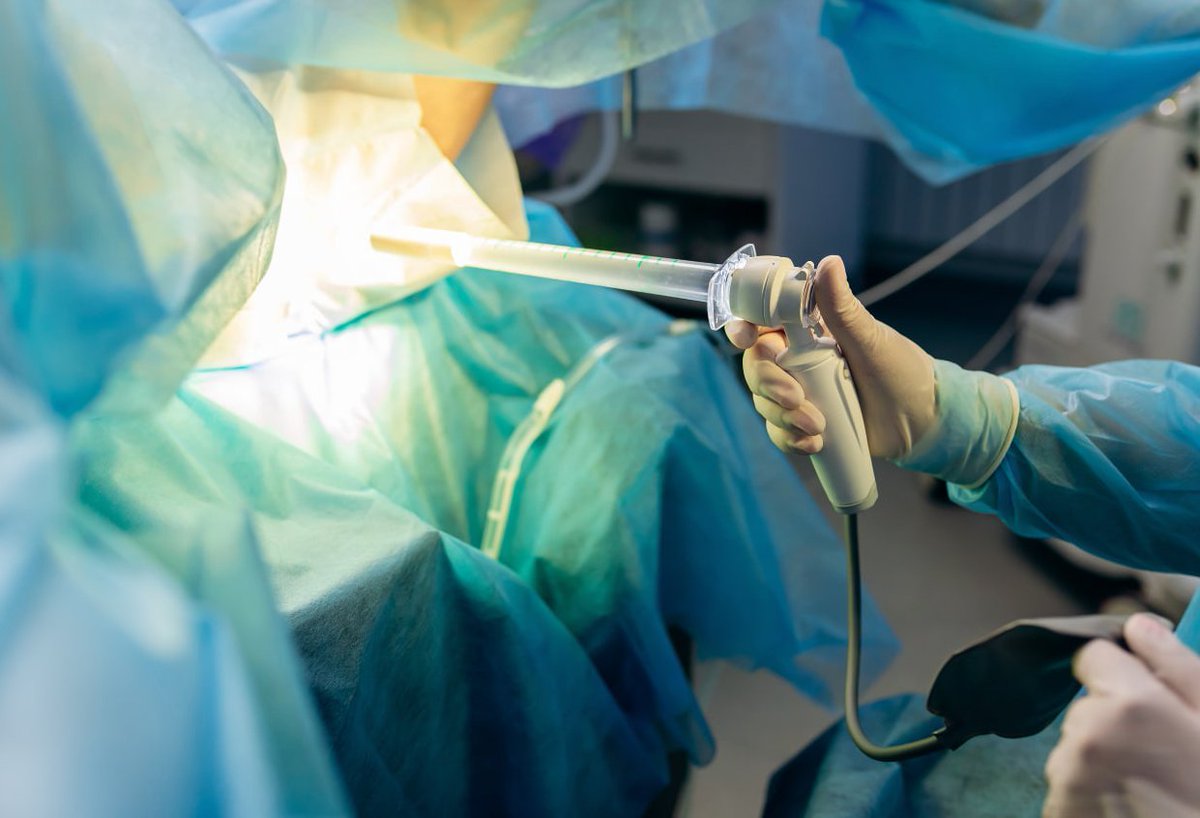 However, there are many risks for colonoscopies—in addition to the risk of sedation.

The risks of colonoscopies include major bleeding (14.6 events per 10,000 performed), perforation (3.1 per 10,000), or infection. These rates are higher than in sigmoidoscopy, a less expensive,