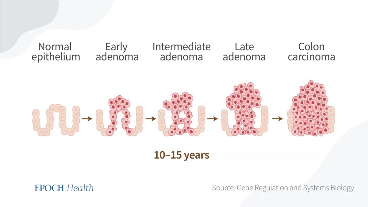 The below figure shows the long process of colon cancer development. If the in situ cancer is identified very early, the five-year survival rate may improve.

But no one can really tell how long it takes for a cancer cell to grow into something lethal, and there are other risks