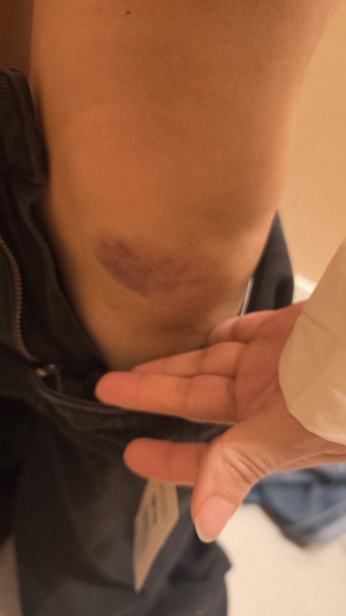 SarahSariSarah's tweet photo. Fui a una entrevista y una clienta dejó todas las sillas un poco desperdigadas no las vi y me pegué un hostion increíble, por favor dejad las sillas en una esquinita plis https://t.co/hrdqBLSLnH