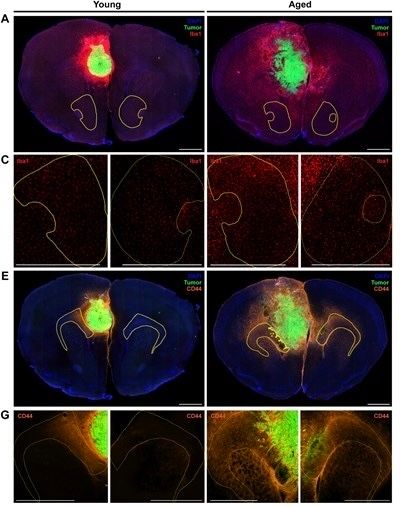 Editor - Neuro-Oncology Advances tweet media