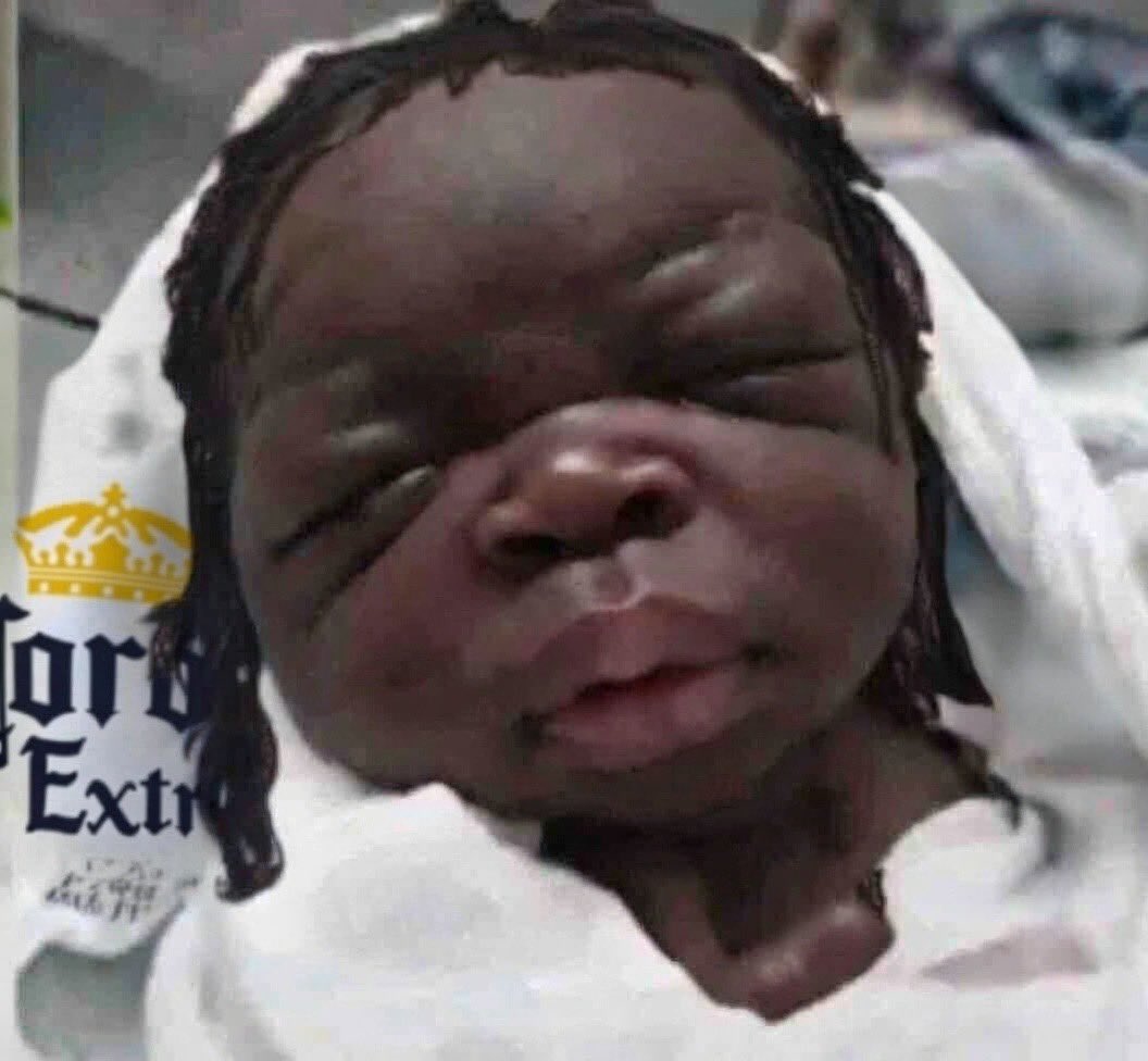 Current situation right 😭😭

The pregnancy                                      The baby