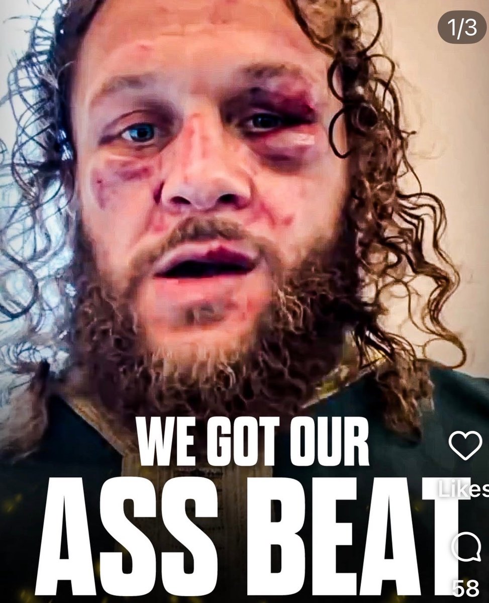 Mathew Tkachuk speaks with reporters after his beatdown by Brandon Hagel  and the Bolts. Lightning 6, Panthers 1. #NHL #TampaBay