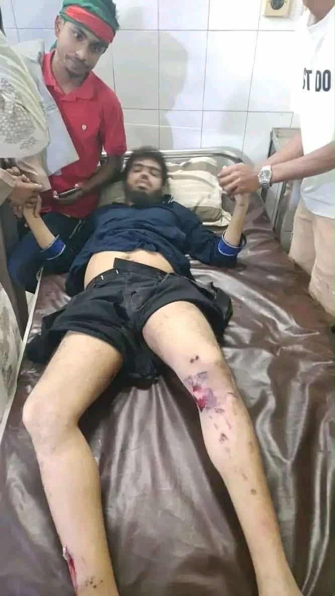 msimiskat's tweet photo. I strongly condemn the cowardly shooting and attack on Abdullah Al Jaber and student leader Salauddin Ammar. Administration fails to arrest killers but fires bullets when justice is demanded. Accountability must prevail today now.
#Inquilab_Zindabad #JusticeForHadi #WeAreHadi https://t.co/C4xIgjSoIg