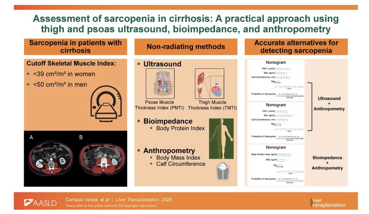 LTxJournal's tweet photo. Assessment of sarcopenia in cirrhosis: A practical approach using thigh and psoas ultrasound, bioimpedance, and anthropometry

https://t.co/idM6kLFXJS https://t.co/0qaowBQgHJ