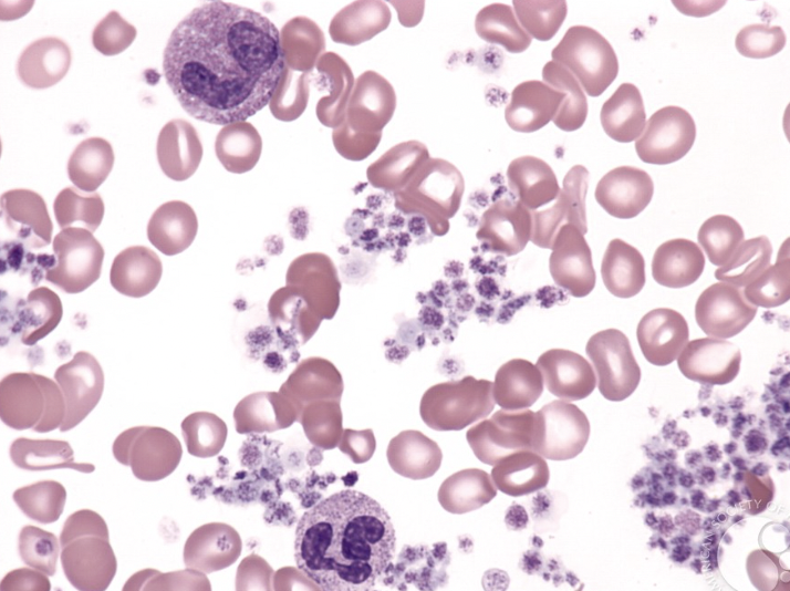 Papa Heme tweet media