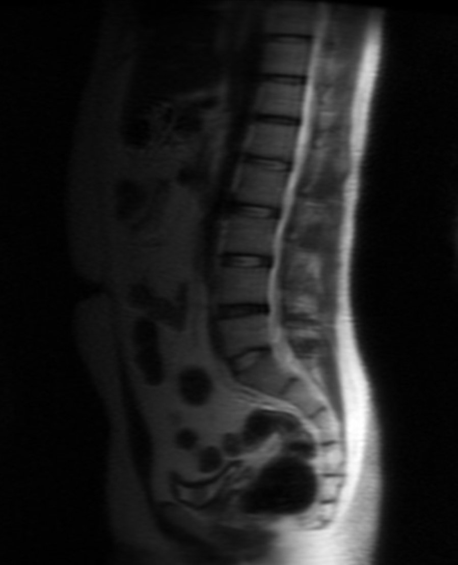 YETKİSİZ SERVİS tweet media