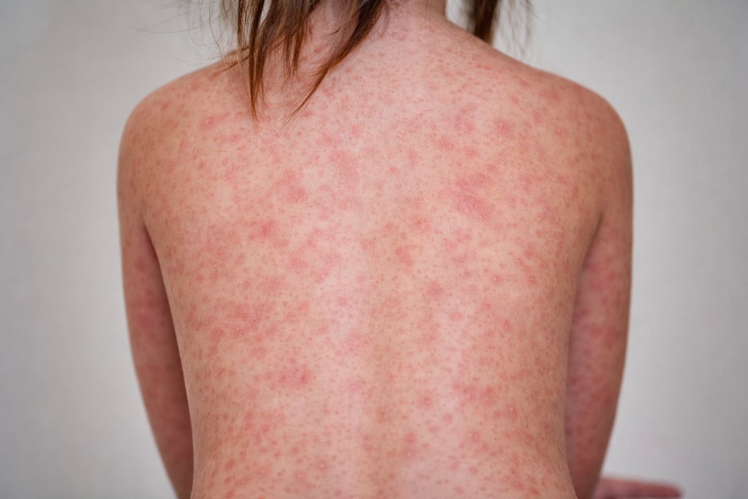 Instituto Balmis de Vacunas tweet media