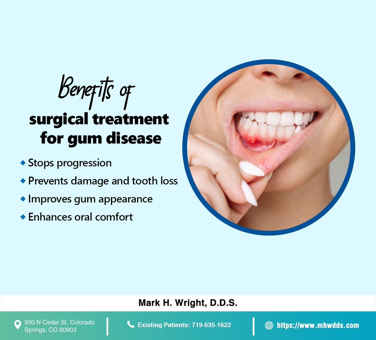 We offer specialized periodontal surgery to combat gum disease and prevent tooth loss. Revitalize your gums and protect your smile with personalized care. Visit mhwdds.com #periodontalsurgery #periodontics #gumhealth #markhwrightdds #coloradosprings #CO