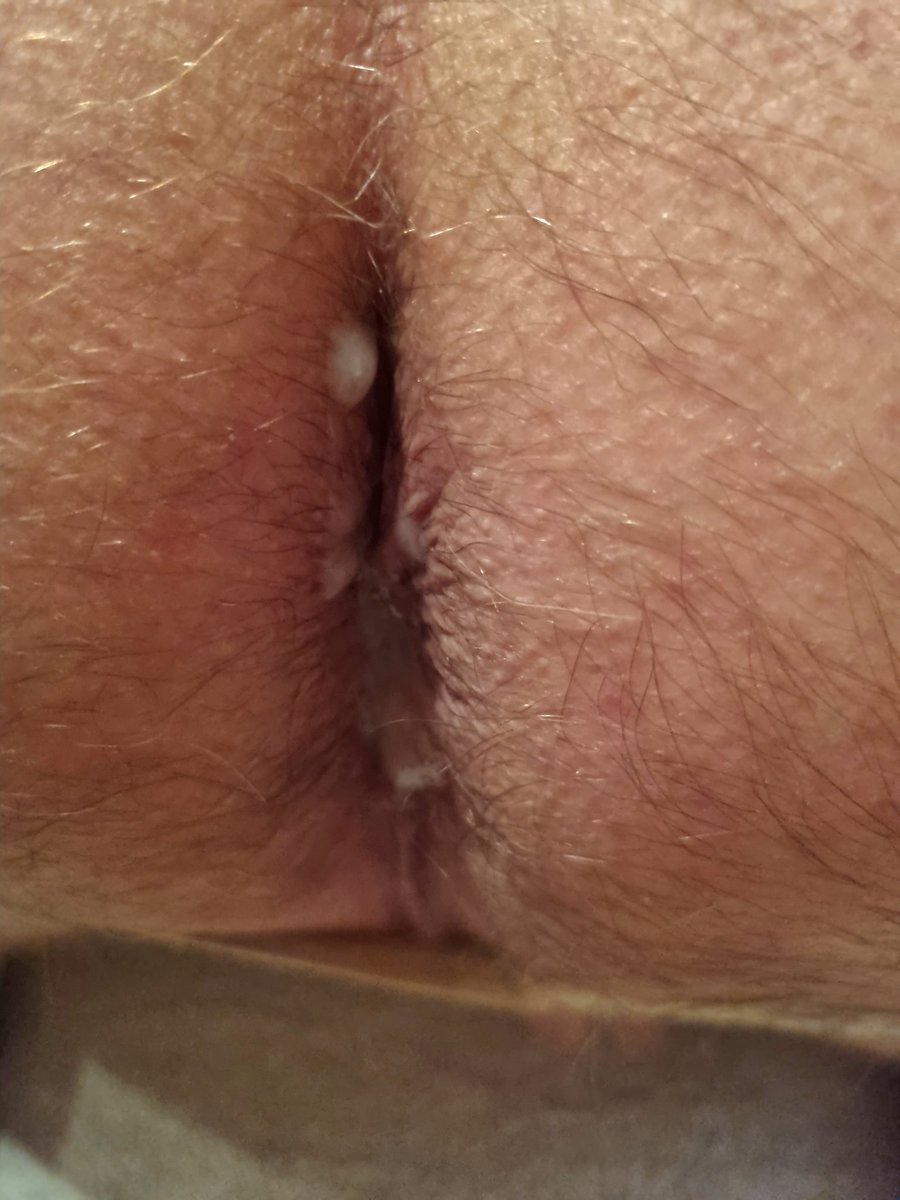 watfordcumdump tweet media