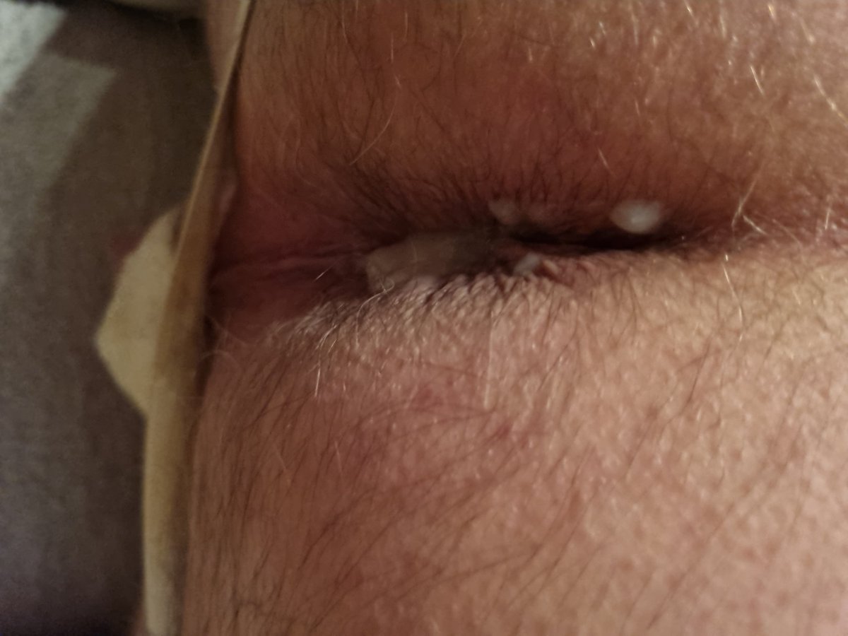 watfordcumdump tweet media