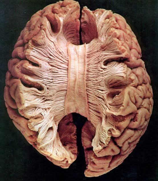 ¿Alguna vez te han dicho que eres una persona "lógica" porque usas más el lado izquierdo de tu cerebro? ¿O que eres un "artista creativo" porque domina tu lado derecho?

​La realidad es que el cerebro no es un equipo de dos bandos divididos. Es una red ultra conectada. 

Aquí te