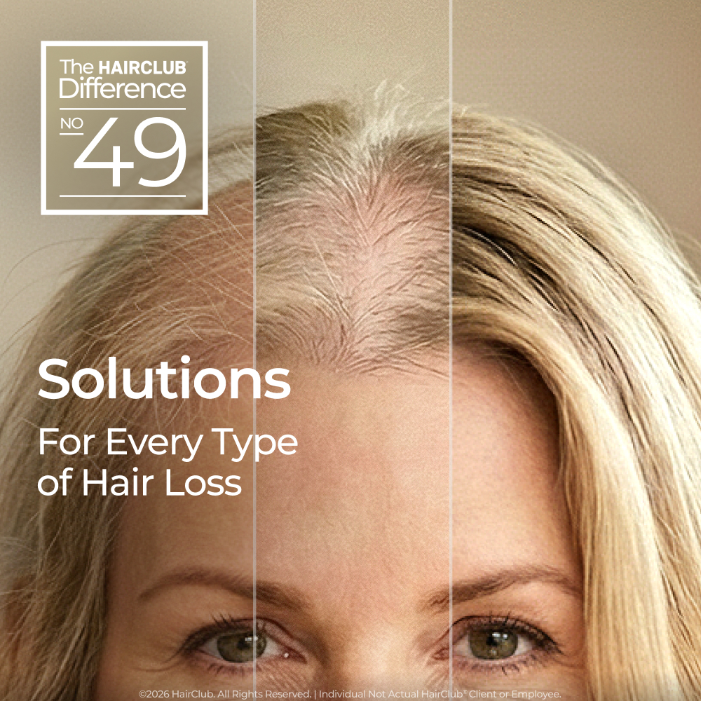 HairClub's tweet photo. Everyone’s #Hairloss is different. HairClub®, the #HairRestoration leader offers personalized options - #HairGrowth products, custom #HairSystems, and surgical** #HairTransplants like #FUE &amp; #FUT. Get a free consultation at 100+ centers. 

Book today - https://t.co/YCDalGtizF https://t.co/ScCKgNhyM0