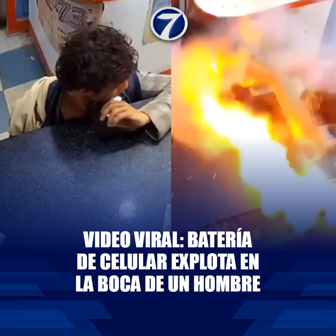Noti7Guatemala's tweet photo. Impactante #video: hombre muerde batería de celular y #explota en su boca 😟➡ https://t.co/u7mp0Sj1hF https://t.co/zkXIpiHDr0