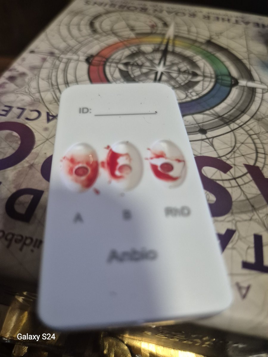 mojintru's tweet image. common blood type here, especially among Caucasians. Good to know I can receive donations from A+, A-, O+, and O- donors! 🩸🧬 #BloodType #Health #Facts