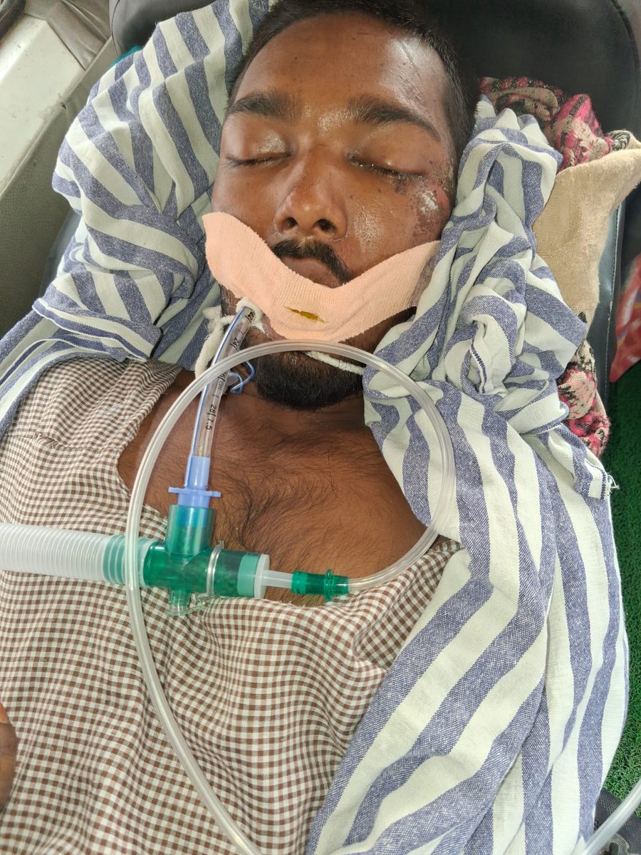 HelpingHand_ktr's tweet photo. Raising funds for Injamul. He is from sanoli ,Katihar Bihar. He is working as  labourer. 
Injamul met with a devastating truck accident that has turned his family’s world upside down. He is the only breadwinner of his family. 
DM for her mother's A/C details. https://t.co/YbSondbDX7