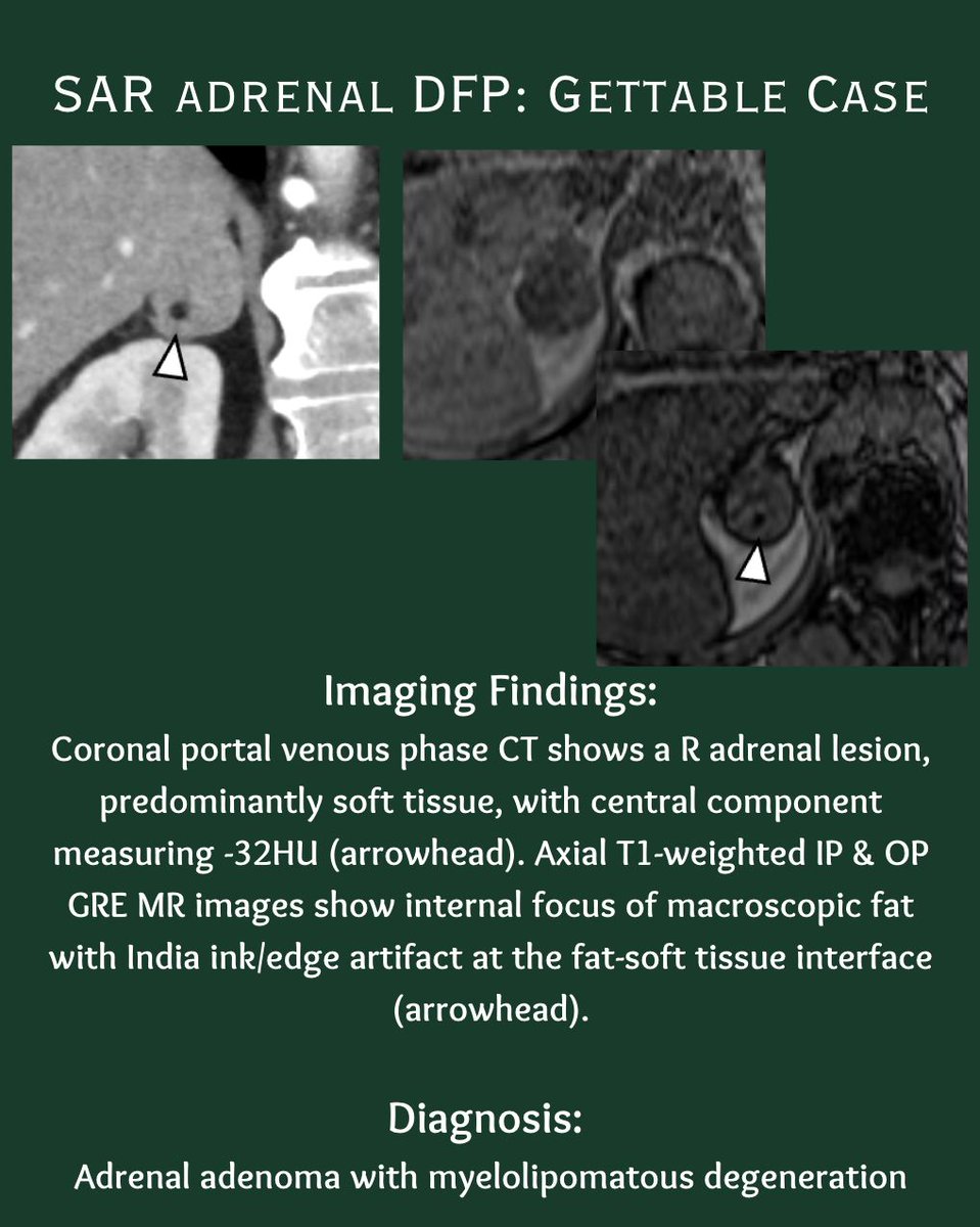 Society of Abdominal Radiology | SAR tweet media