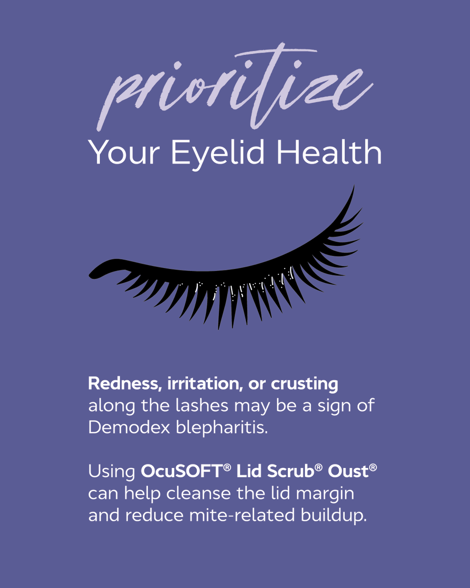 Redness, irritation, or crusting along your lashes can be signs of Demodex blepharitis. Daily lid hygiene with OCuSOFT Lid Scrub Oust helps cleanse the lid margin and reduce mite-related buildup for healthier, more comfortable eyes.