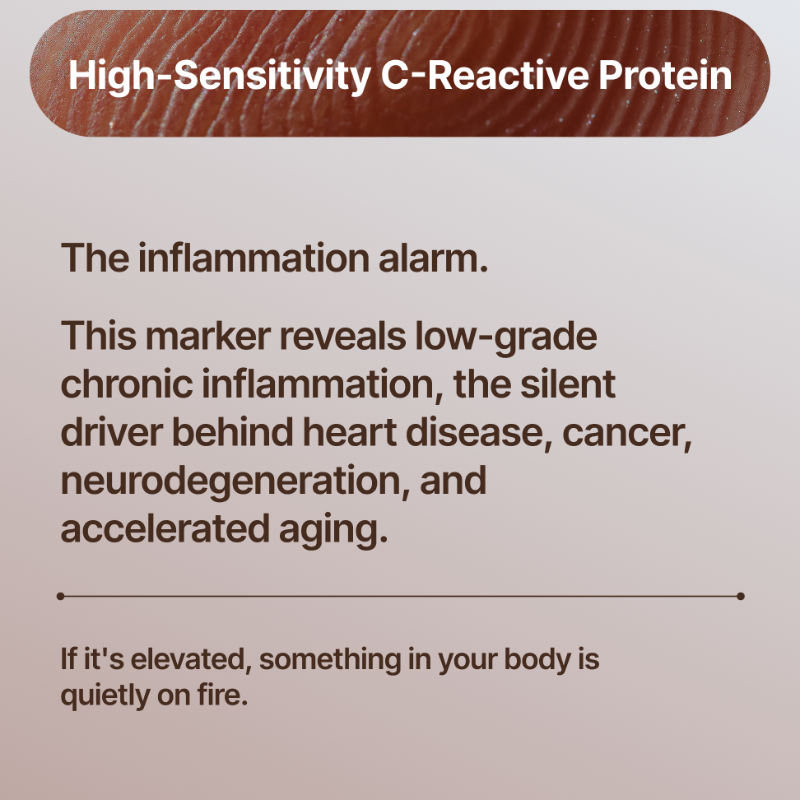 NovosLabs's tweet photo. Your lifespan isn't a mystery. It's measurable.

These biomarkers don't just predict disease, they reveal how fast you're aging at the cellular level.

The good news? Each is modifiable through nutrition, physical activity, sleep, and lifestyle.

Test. Track. Intervene early.