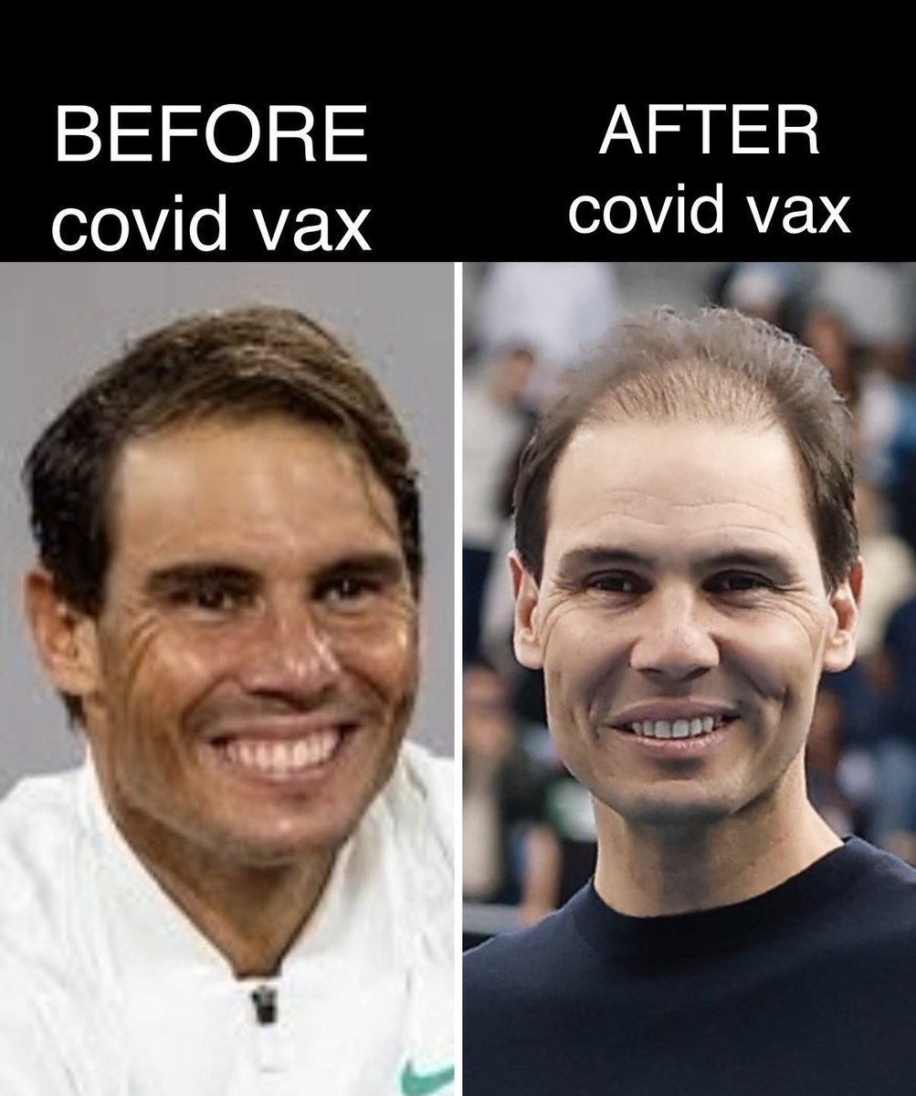 MartinN03309127's tweet photo. @DjokovicFan_ Currently Novak versus currently Rafa.. well, before got hair implant.. #Idemooooo!! https://t.co/DcKL60w2GO