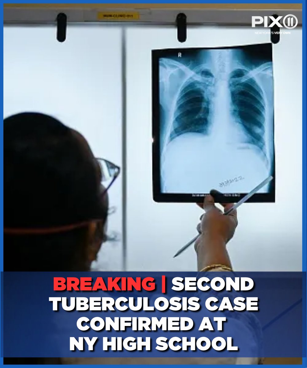 PIX11News's tweet photo. #BREAKING | A second person has been diagnosed with tuberculosis at an NY high school.

Details: https://t.co/t4s5DlkQRL https://t.co/N8OoEhnY6g