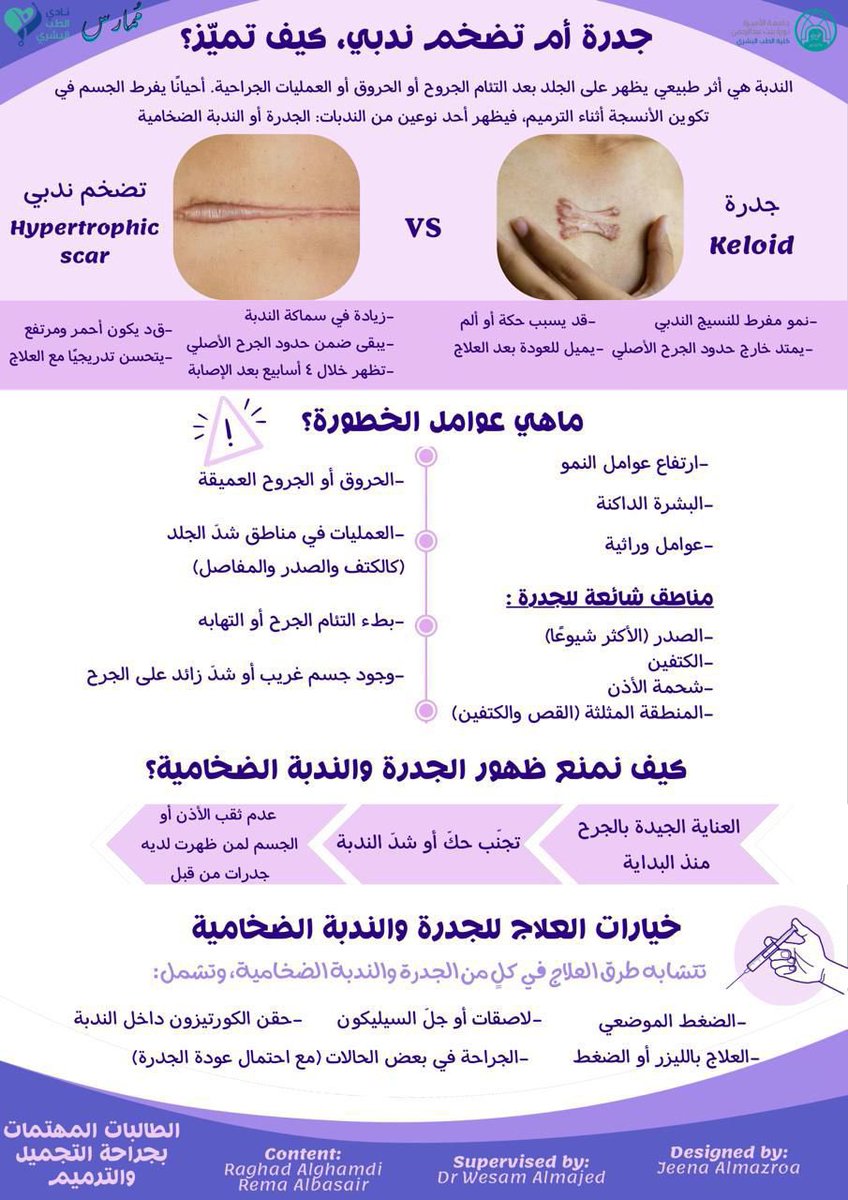 JMAAlMa's tweet photo. لأن كل ندبة لها قصة ✨
تعرفوا على الفرق بين الجُدرة والندبة الضخامية في هذا البوستر

قراءة ممتعة💜

الطالبات المهتمات بجراحة التجميل والترميم🪡 https://t.co/iyA7Z0FZzL