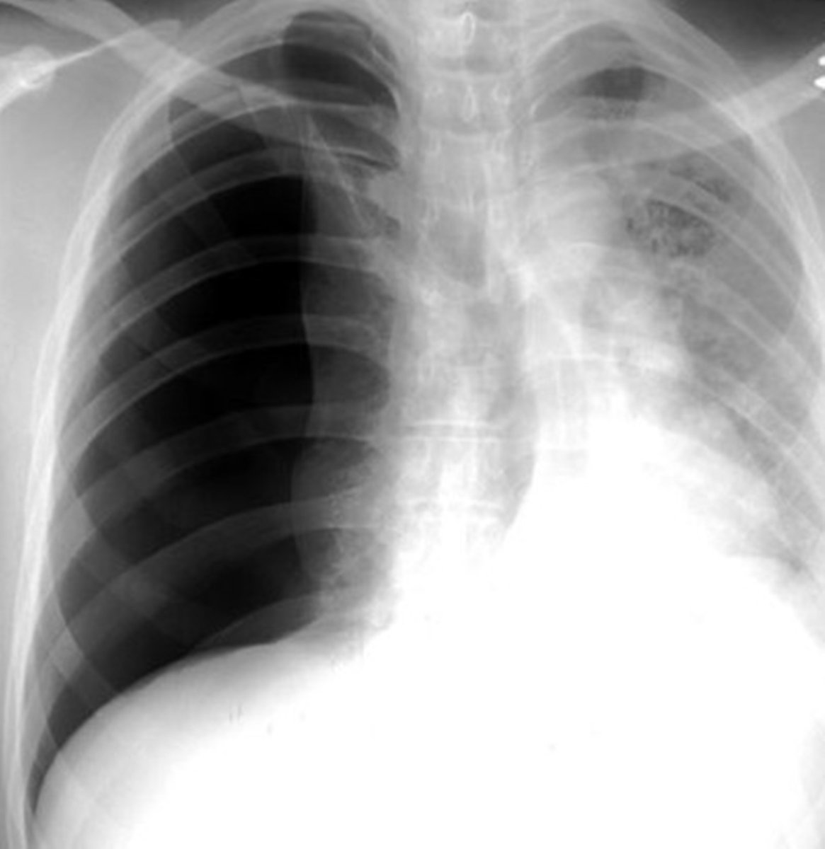 modernHealthMe's tweet photo. What do you see? https://t.co/1YtAR4TKeb