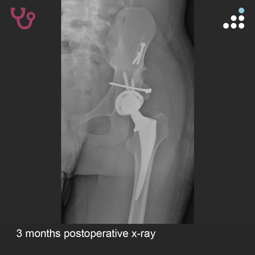 Orthobullets tweet media