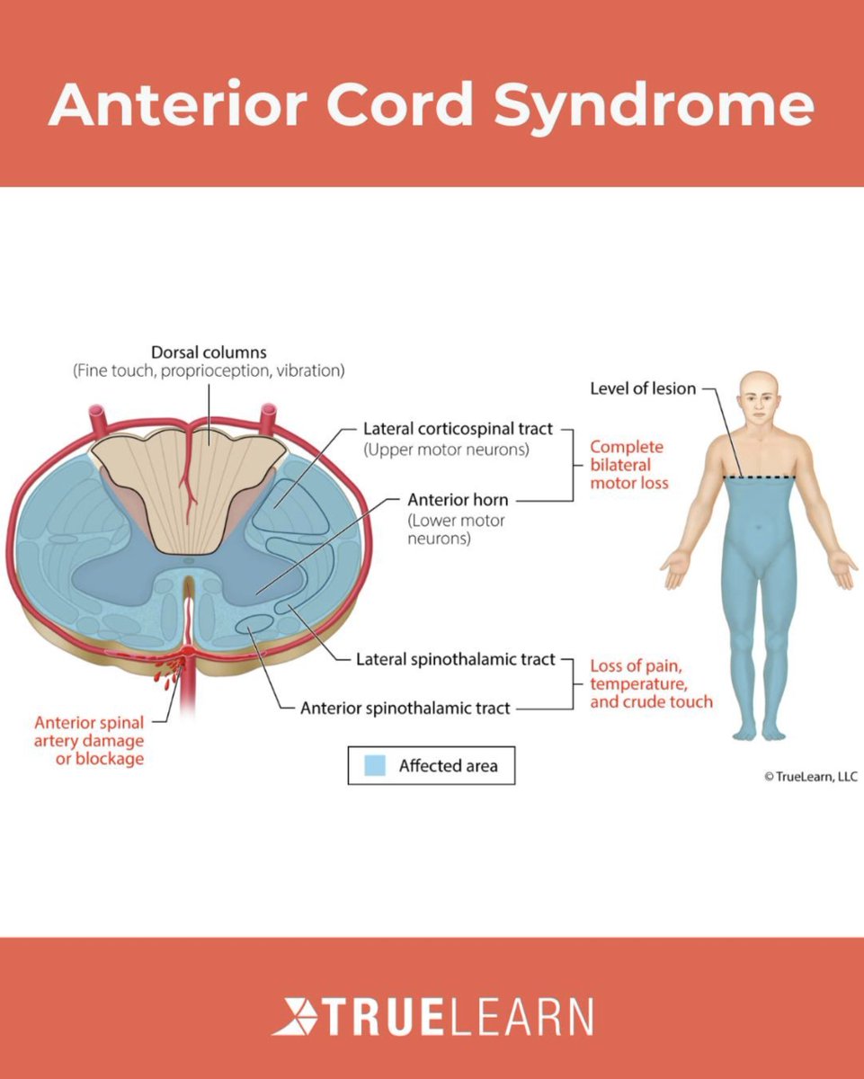 TrueLearn tweet media
