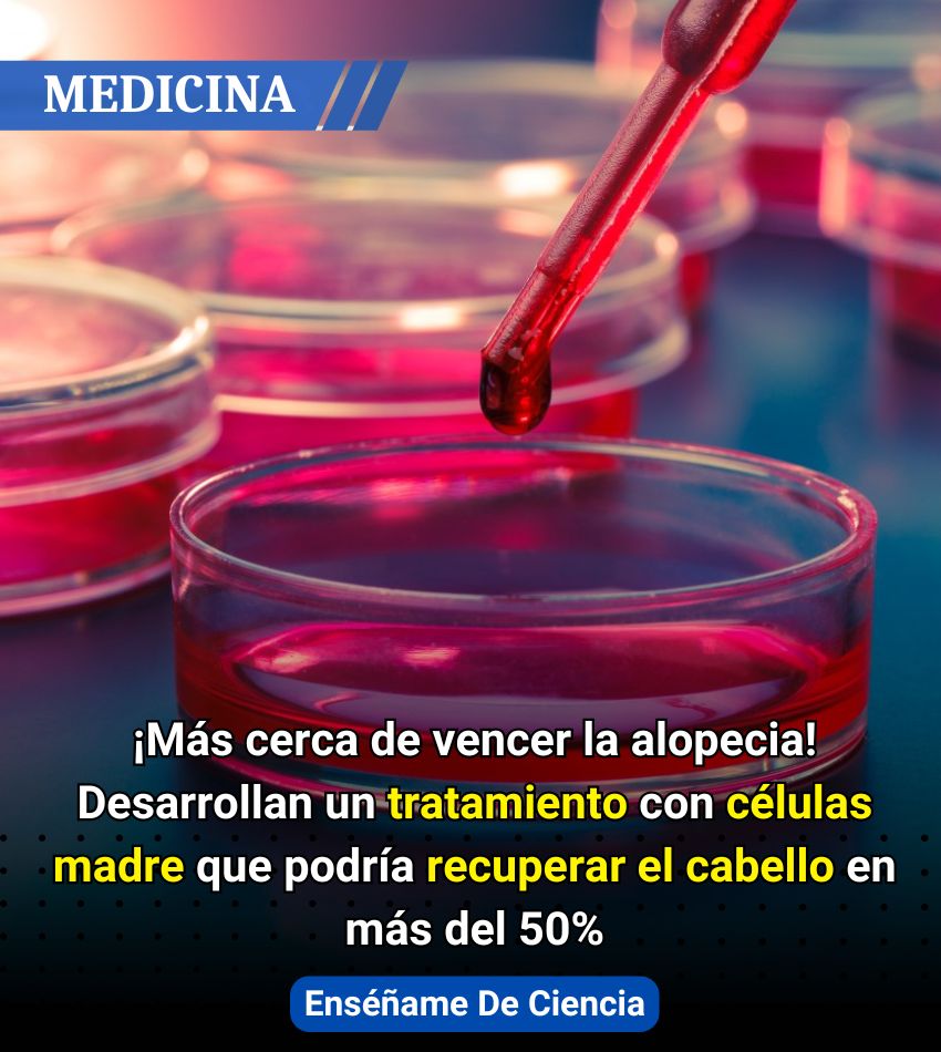 💥Un grupo de dermatólogos españoles del Hospital Clínico San Carlos de Madrid ha encontrado un novedoso método con el que se podría revertir la alopecia. Los resultados del estudio se publicaron en la revista Stem Cell Research and Therapy, y han sido altamente positivos.

Este