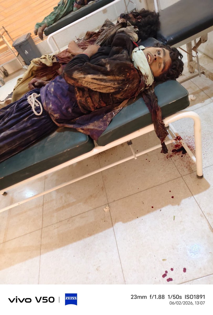 These boys came to Noshki carrying little more than the hope that honest labour might ease the burden on their families back in Sindh, because poverty leaves no room for comfort and survival often demands distance from home.

They were young boys from poor households, working