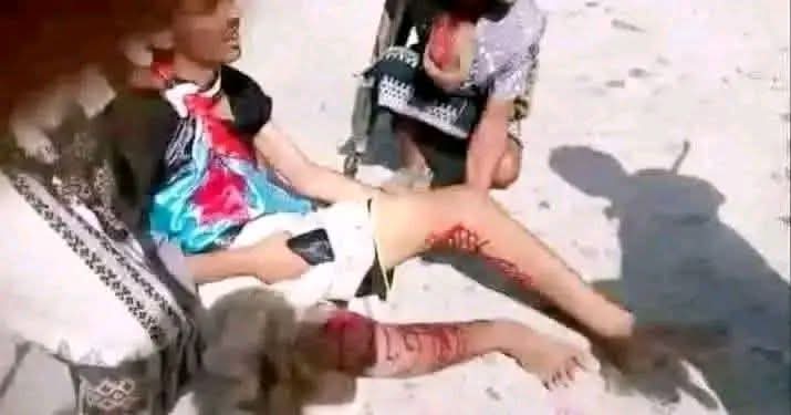 الدماء التي سالت في حضرموت اليوم هي الرد الحقيقي على كذبة "حضرموت للحضارم" التي روج لها الغزاة. 
والرصاص الذي يُطلق على المتظاهرين السلميين اليوم هو الدليل الأكبر على أنهم يخشون صوت الحضارم الحقيقي الذي يرفض التبعية .