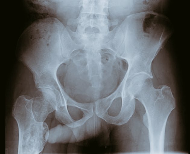 CircumcisionMen's tweet photo. Nurse: "Doctor he is #teamCut ! 
Everything is fine!" 🤭🤓 https://t.co/FCrJ8A6dI7