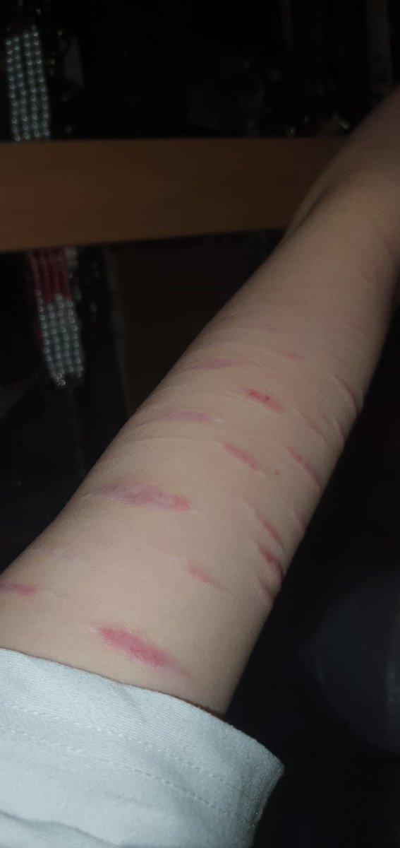Fridgee_ee's tweet photo. @BubblesH84180 Also healed but I lwk love em😛 https://t.co/hUvnoREQ8l