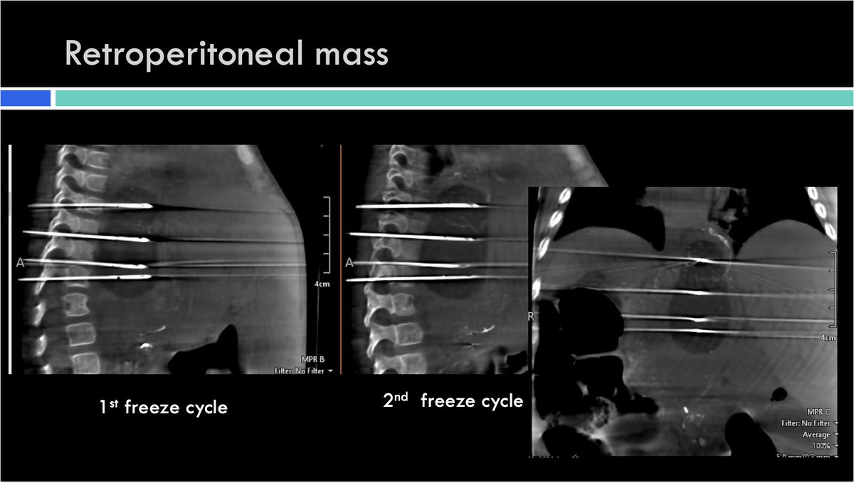 Radiology Children's Healthcare of Atlanta tweet media
