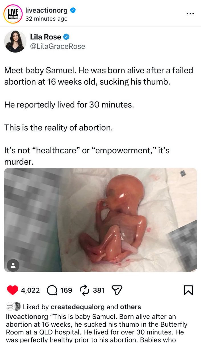 ProfJoannaHowe's tweet photo. I woke up this morning to see that the biggest prolife account in the world @LiveAction led by the incredible @LilaGraceRose had shared baby Samuel's story. I am so grateful for the very brave whistleblower who came forward with this photo and trusted it to me.

That person broke the law, risked their career and has felt sick in the stomach this week at the mob's witch hunt to expose them. However, I believe this person's tremendous courage will be part of the foundation blocks for ending abortion in Australia and worldwide. We all need courage for this fight and to step up when the moment comes, just like this brave person did.