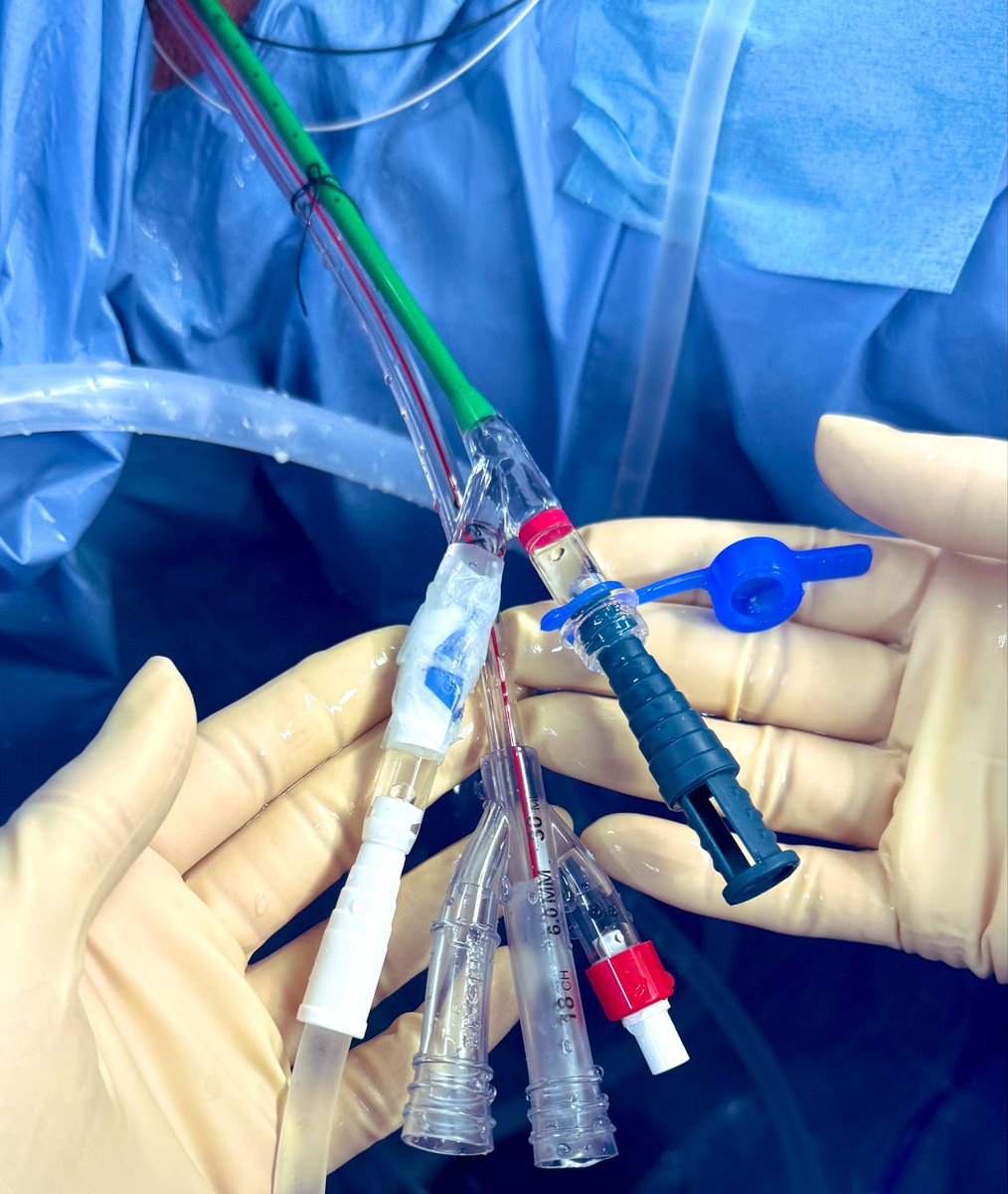 sergiofumero's tweet image. Primera incursión en i-PCNL (by @uroServera) Muy buenas sensaciones. A poco que depuremos la técnica no habrá marcha atrás!! 
#LELR