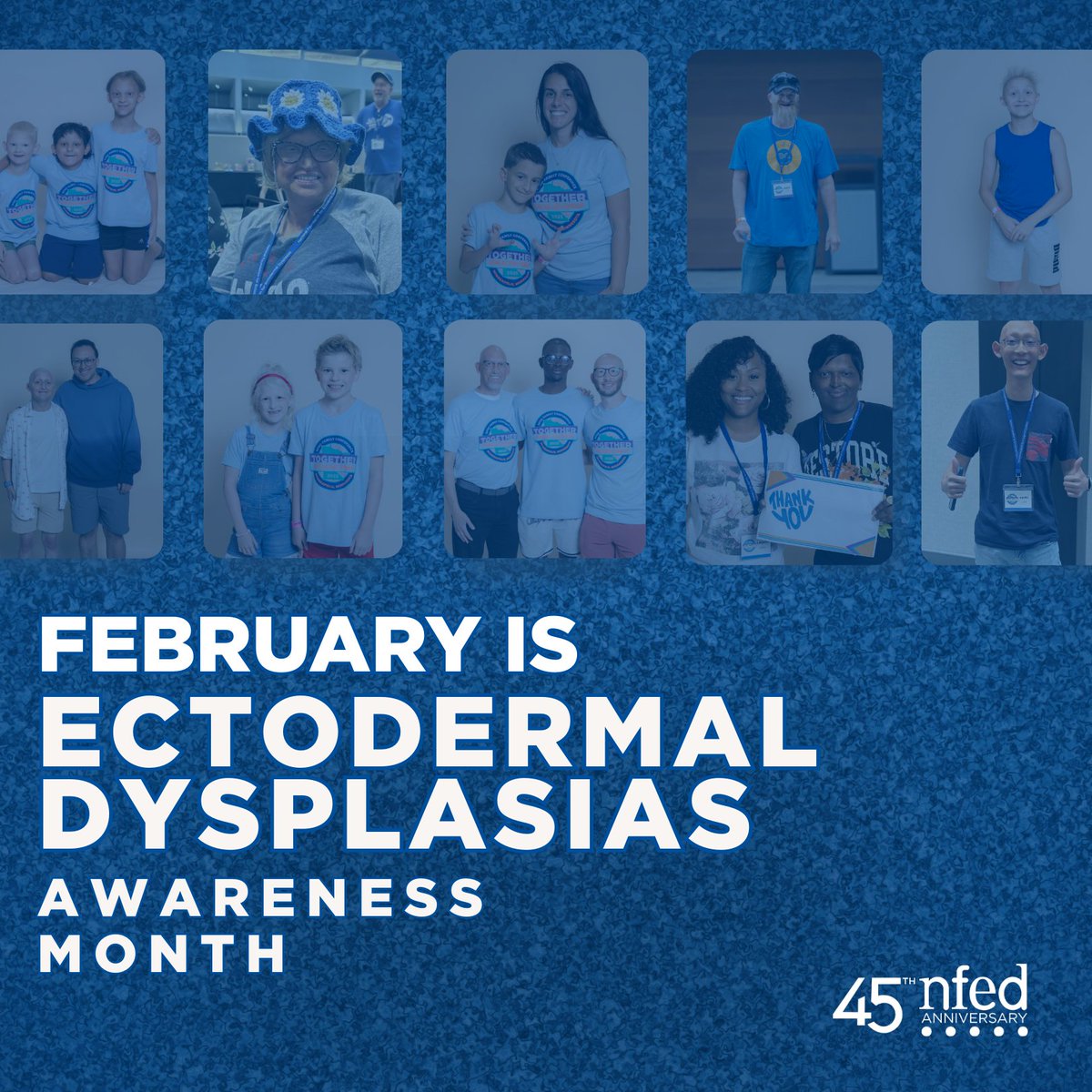 February is #EctodermalDysplasiasAwareness Month!

#DYK? Ectodermal dysplasias affect hair, teeth, nails, sweat glands and skin. 

Learn more from the National Foundation for Ectodermal Dysplasias: bit.ly/45GVTka