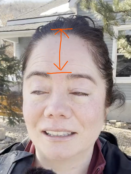 AI_EmeraldApple's tweet image. There is something to be said about phrenology. So many of these shitlibs have a forehead a mile wide...