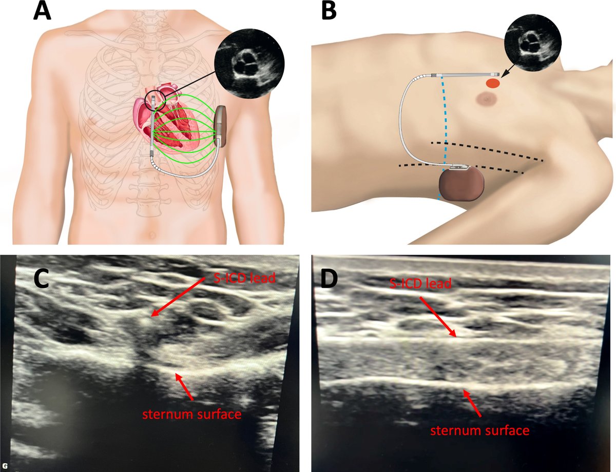 HeartRhythm tweet media