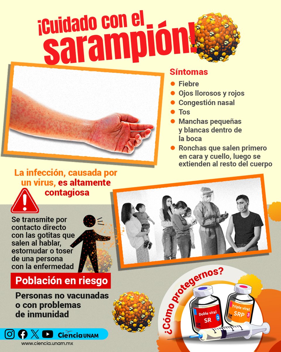 #Salud | ¡Cuidado con el #sarampión! Es uno de los virus más contagiosos. Ante el incremento de casos y muertes en el mundo ¿Cómo estar protegidos?
Signos, síntomas, complicaciones, qué hacer y más en el cartel #UNAMirada: bit.ly/4blrzvH