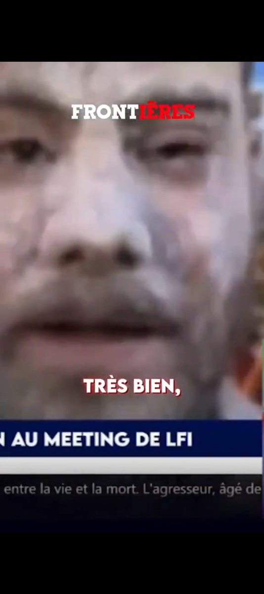 Bobby 🇫🇷 tweet media